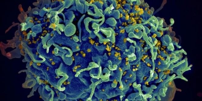 Pesquisadores brasileiros podem ter descoberto cura da AIDS