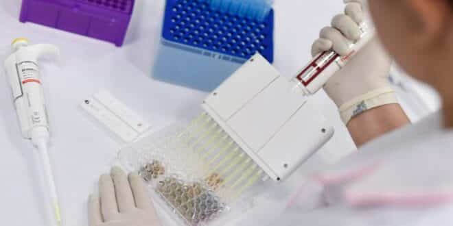 MG - Governo de Minas adquire 20 mil testes para Covid-19