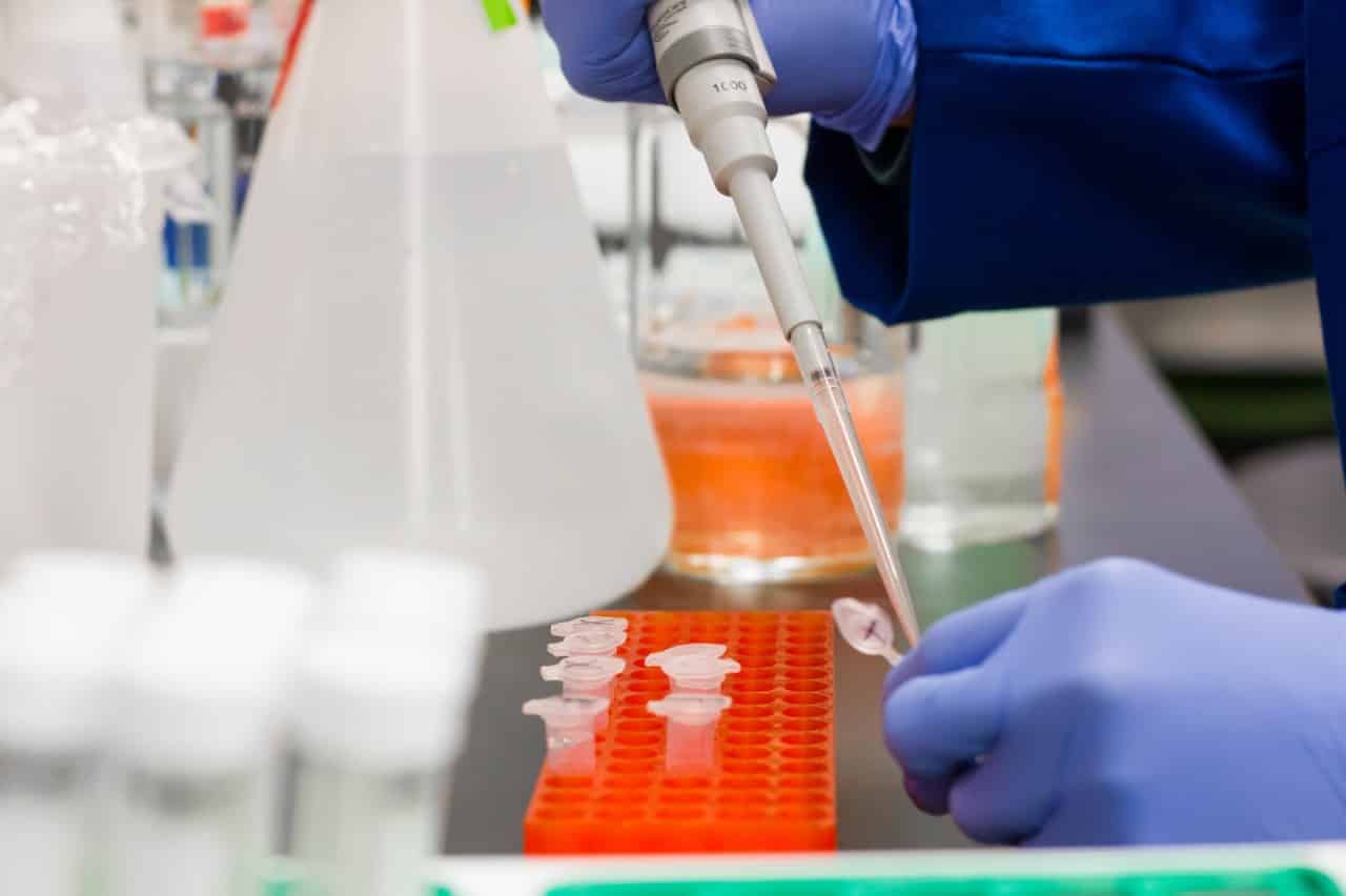 Estudo feito pela Fiocruz alerta que Covid-19 pode causar danos cerebrais