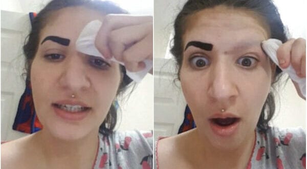 Garota fica sem sobrancelha depois de usar produto comprado pela internet