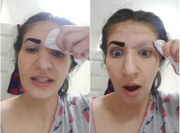 Garota fica sem sobrancelha depois de usar produto comprado pela internet
