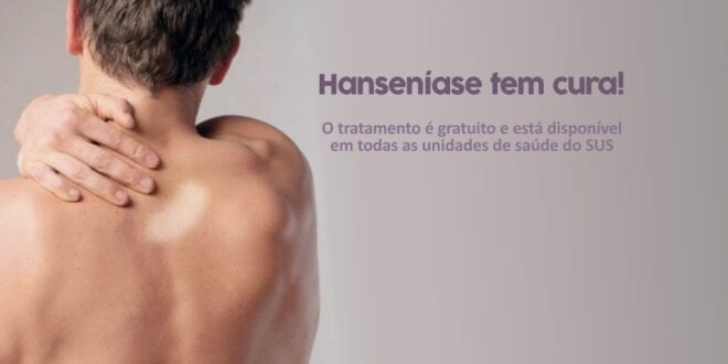 MG - Minas Gerais está entre os dez estados mais afetados pela hanseníase no Brasil, com mais de 12 mil casos na última década