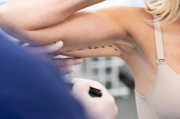 Plano de saúde negou a cirurgia reparadora? Saiba como agir!