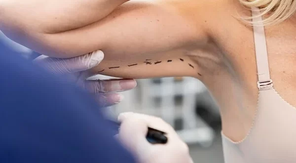 Plano de saúde negou a cirurgia reparadora? Saiba como agir!