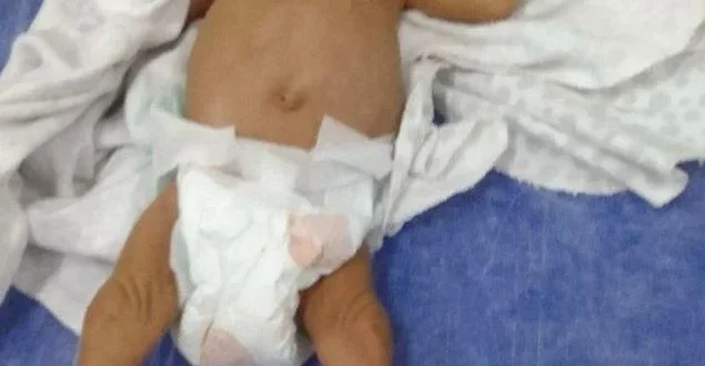 Bebê prematuro é salvo após engasgo em Coração de Jesus