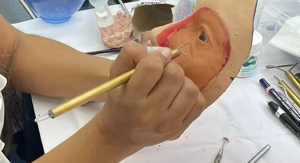 Startup de Montes Claros devolve qualidade de vida a pacientes com mutilação facial por câncer