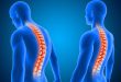 Coluna Vertebral