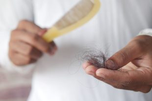 sinais precoces de queda de cabelo